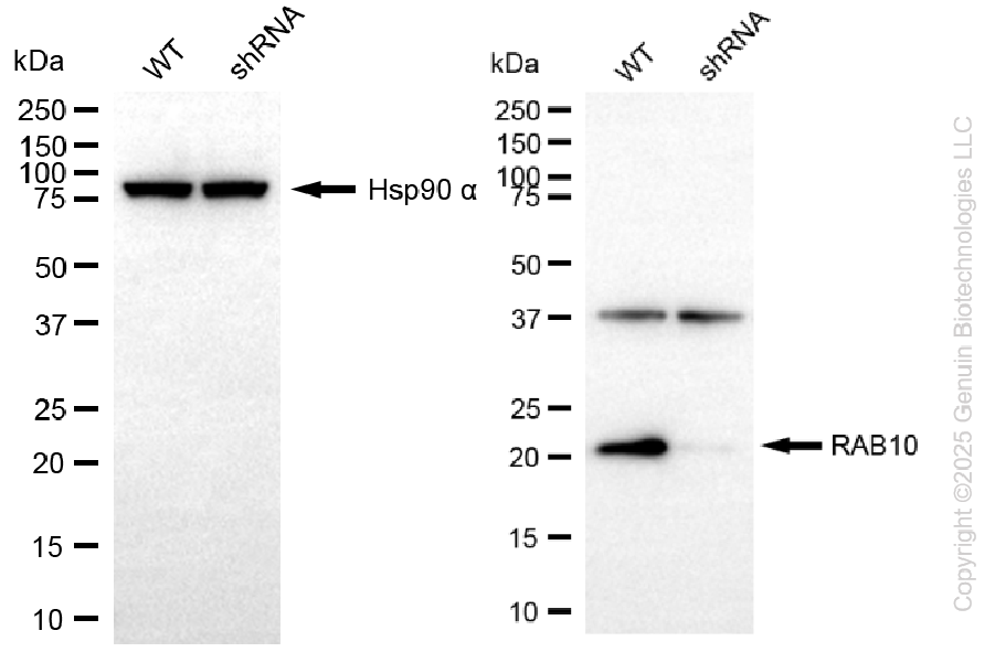 KD-Validated Anti-RAB10 Rabbit Monoclonal Antibody ABG2263