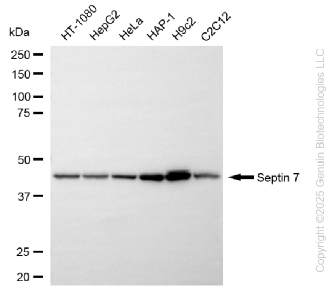 KD-Validated Anti-Septin 7 Rabbit Monoclonal Antibody ABG2265