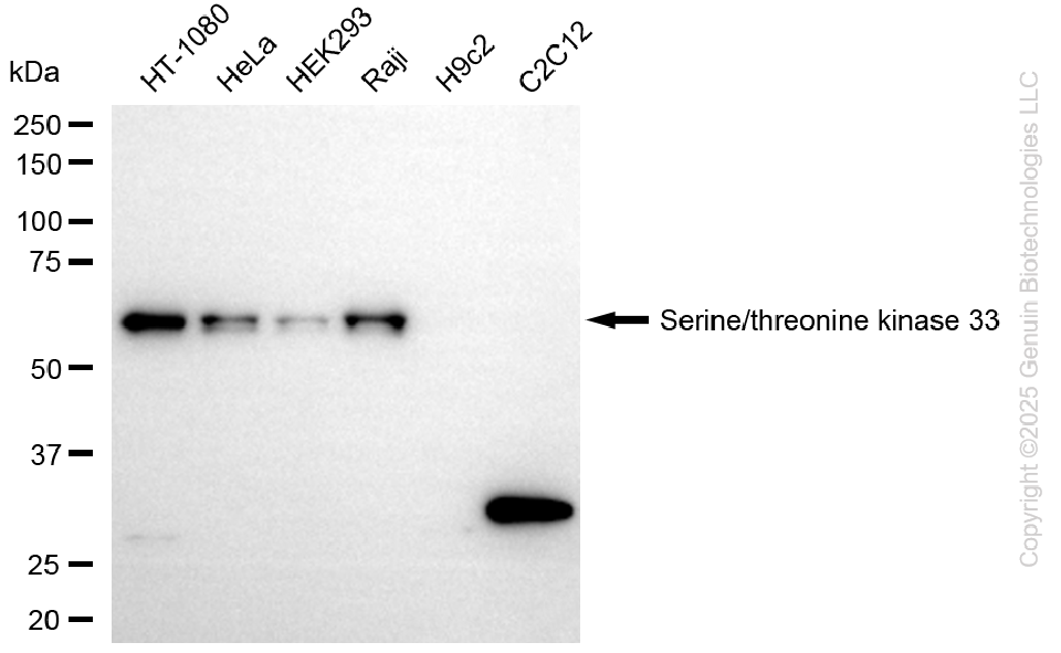 KD-Validated Anti-STK33 Rabbit Monoclonal Antibody ABG2269