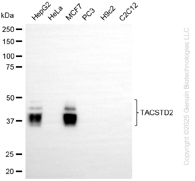 KD-Validated Anti-TACSTD2 Rabbit Monoclonal Antibody ABG2271
