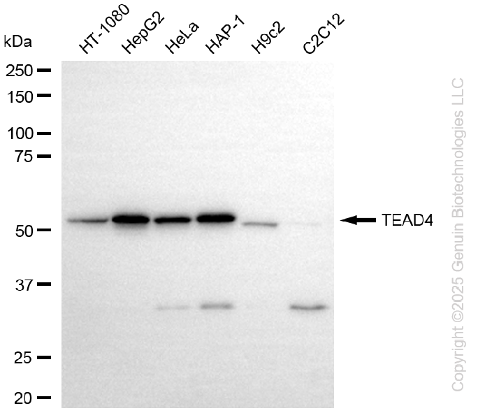 KD-Validated Anti-TEAD4 Rabbit Monoclonal Antibody ABG2273