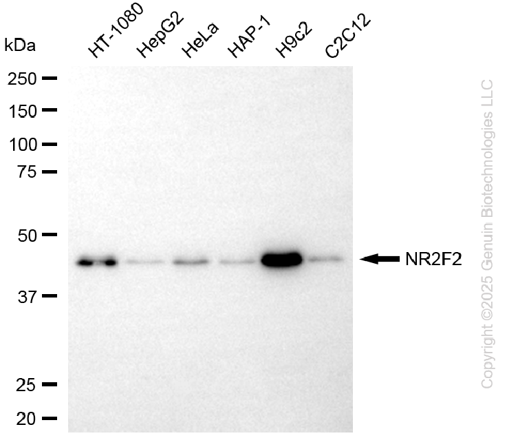 KD-Validated Anti-NR2F2 Rabbit Monoclonal Antibody ABG2283