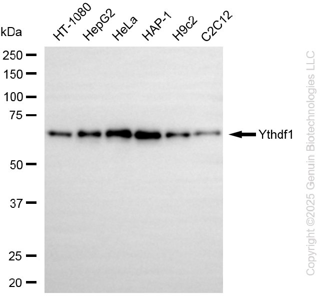 KD-Validated Anti-YTHDF1 Rabbit Monoclonal Antibody ABG2289