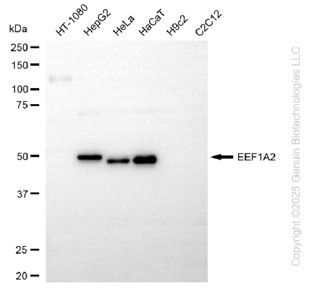 KD-Validated Anti-EEF1A2 Rabbit Monoclonal Antibody ABG2291