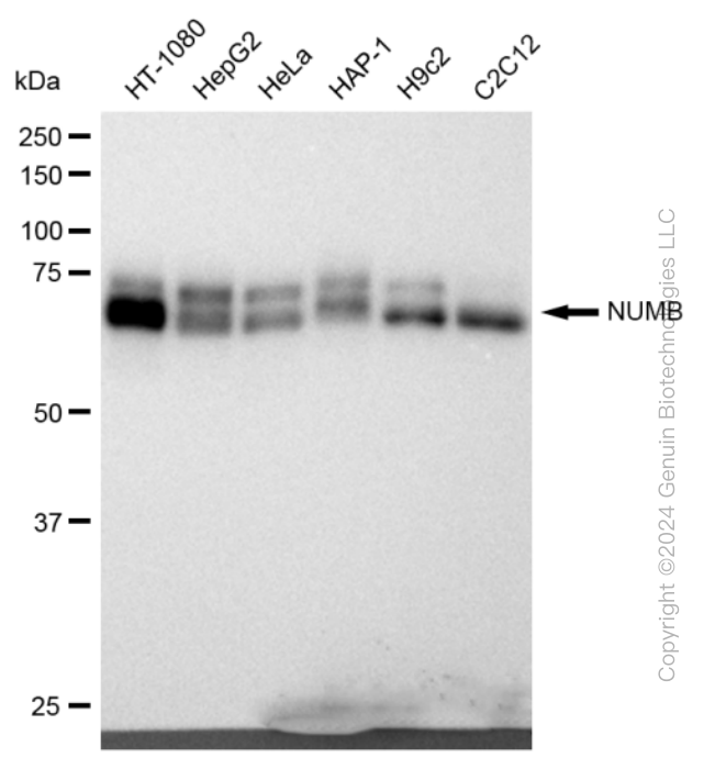 KD-Validated Anti-NUMB Rabbit Monoclonal Antibody ABG2294