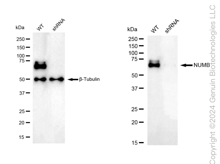 KD-Validated Anti-NUMB Rabbit Monoclonal Antibody ABG2294