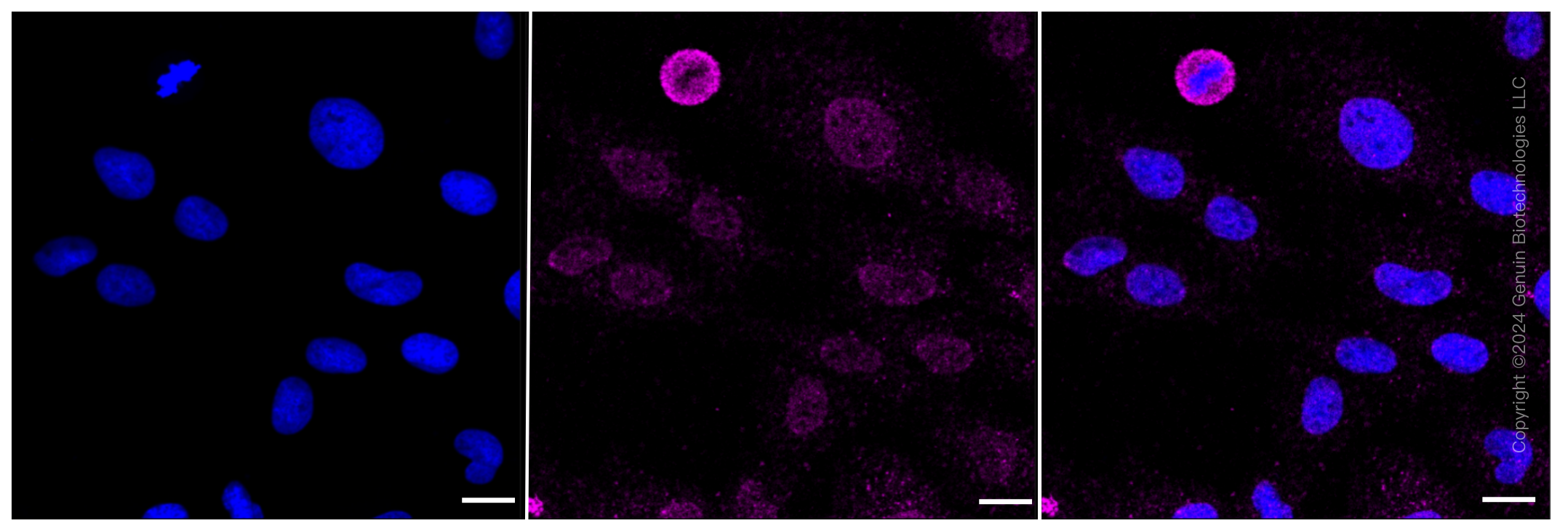 KD-Validated Anti-Ephrin Receptor B4 Rabbit Monoclonal Antibody ABG2299