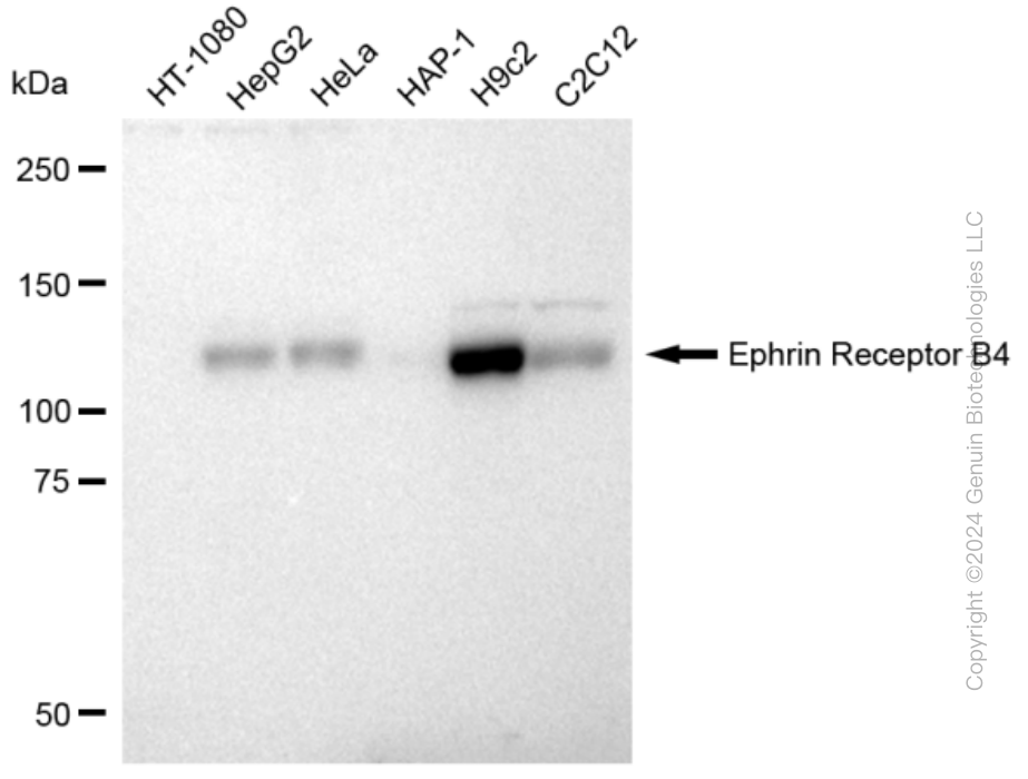 KD-Validated Anti-Ephrin Receptor B4 Rabbit Monoclonal Antibody ABG2299