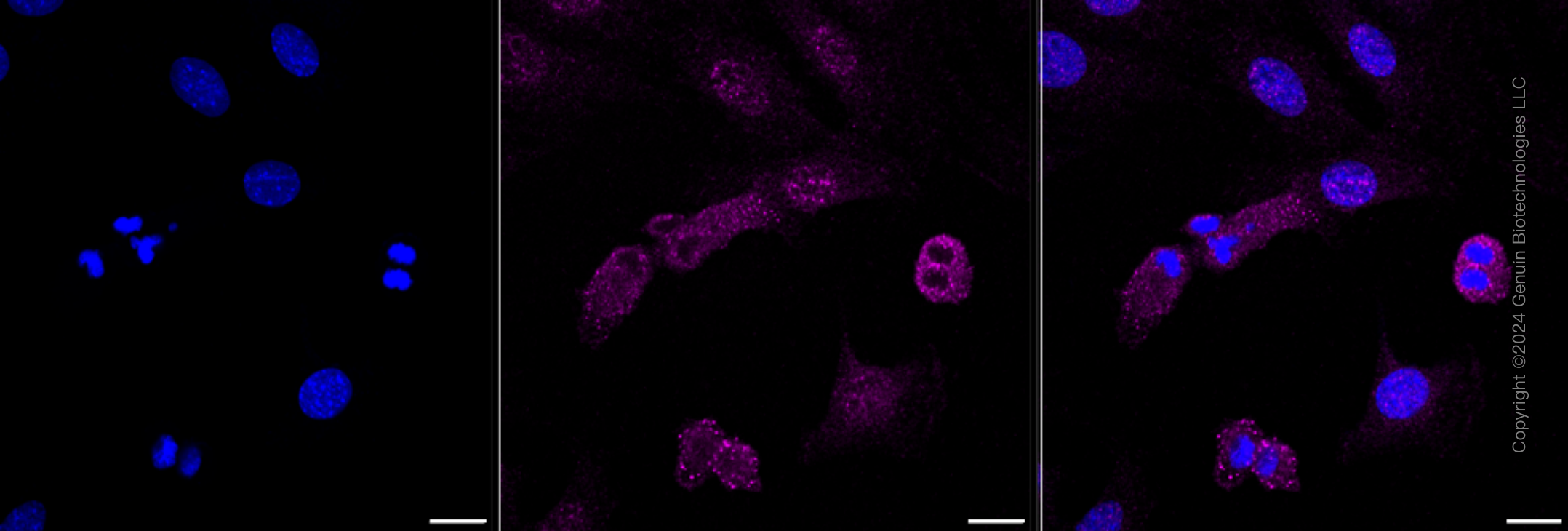KD-Validated Anti-alpha smooth muscle Actin Rabbit Monoclonal Antibody ABG2304