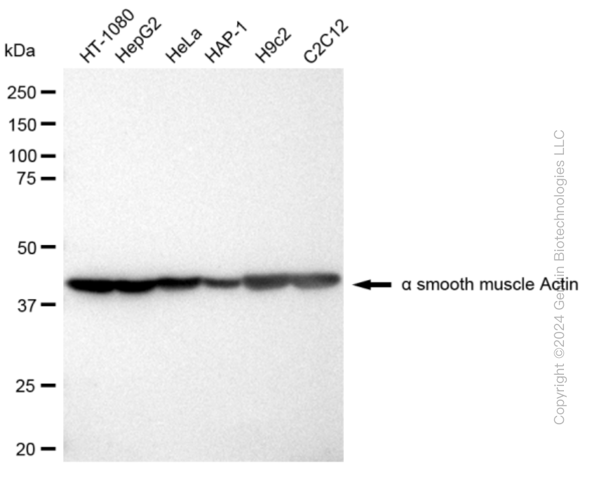 KD-Validated Anti-alpha smooth muscle Actin Rabbit Monoclonal Antibody ABG2304