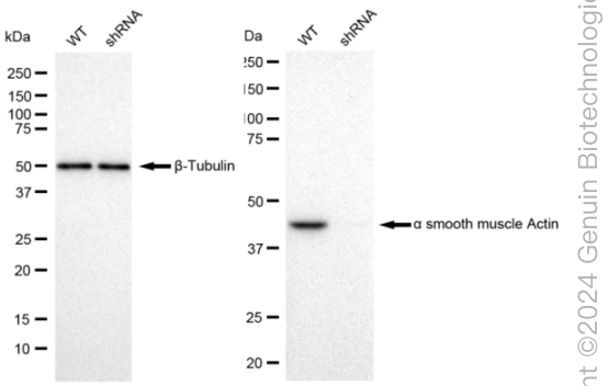 KD-Validated Anti-alpha smooth muscle Actin Rabbit Monoclonal Antibody ABG2304