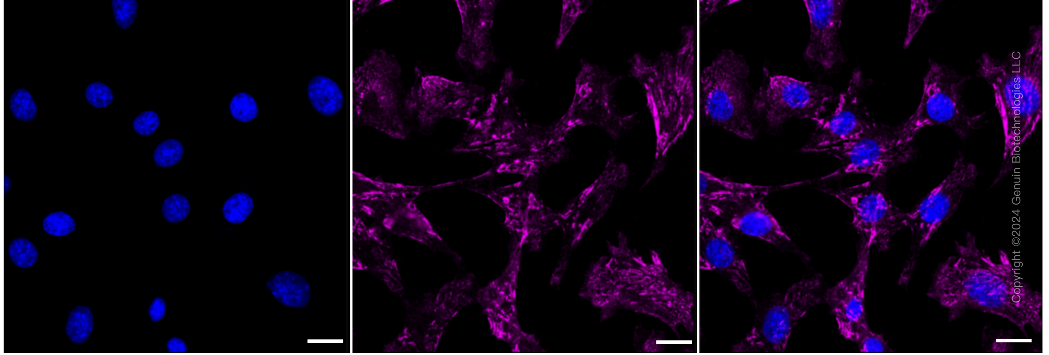 KD-Validated Anti-Integrin alpha 5 Rabbit Monoclonal Antibody ABG2306
