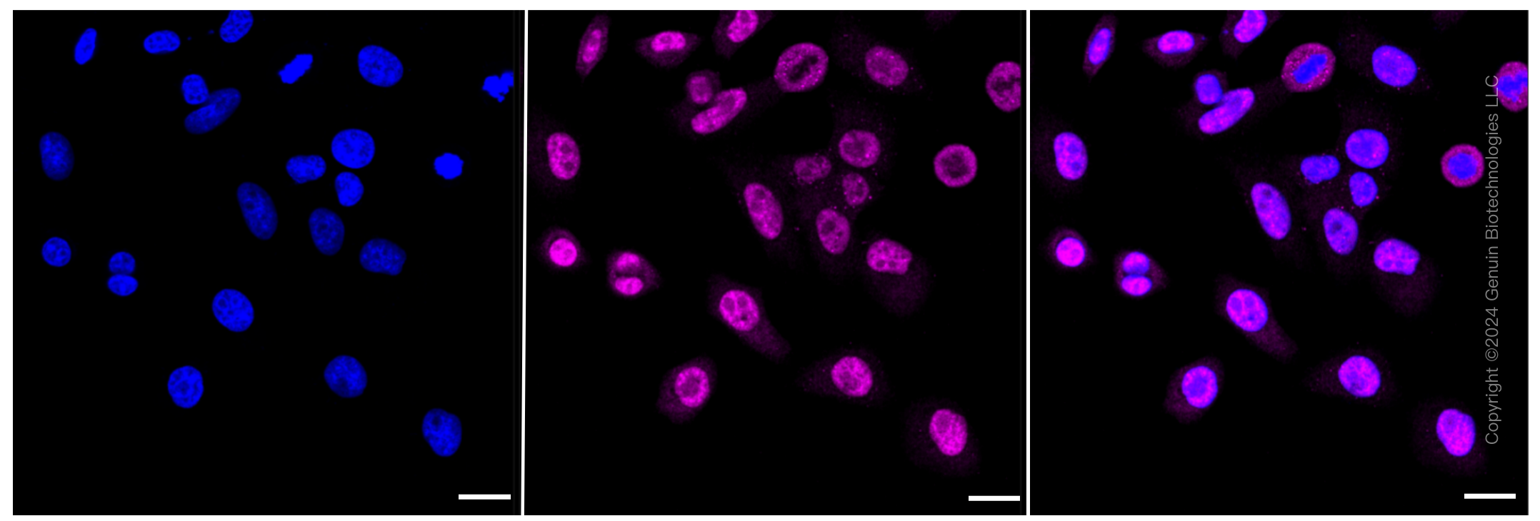 KD-Validated Anti-Chromodomain helicase DNA binding protein 3 Rabbit Monoclonal Antibody ABG2307