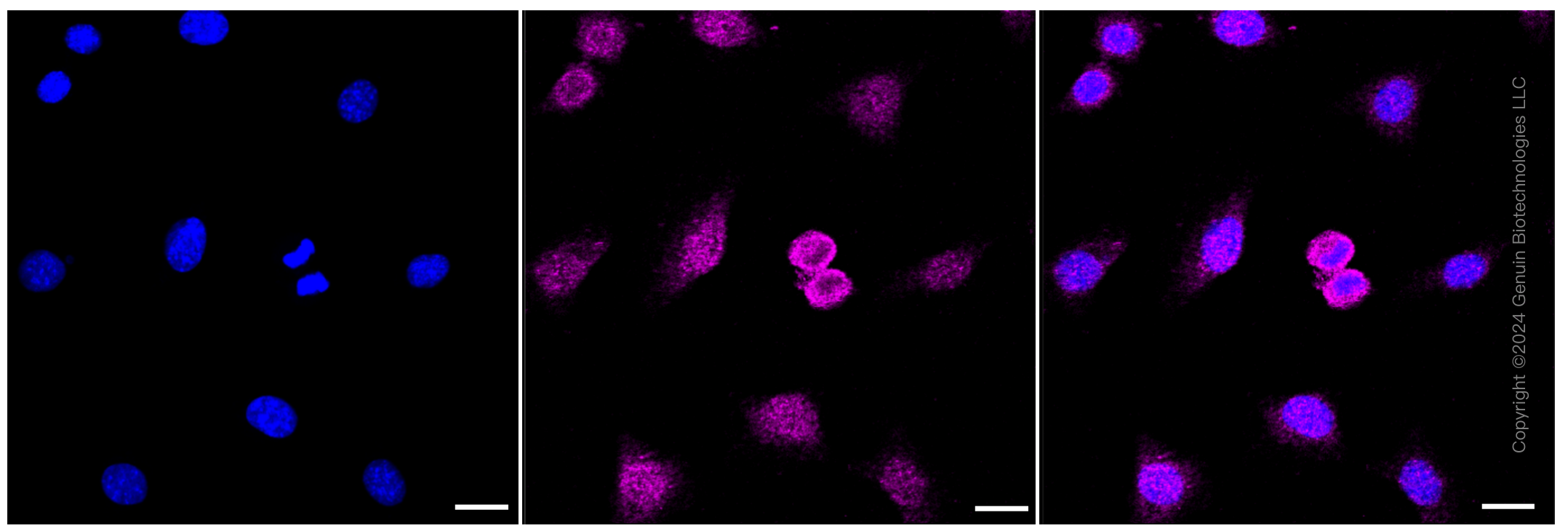 KD-Validated Anti-Smad4 Rabbit Monoclonal Antibody ABG2312
