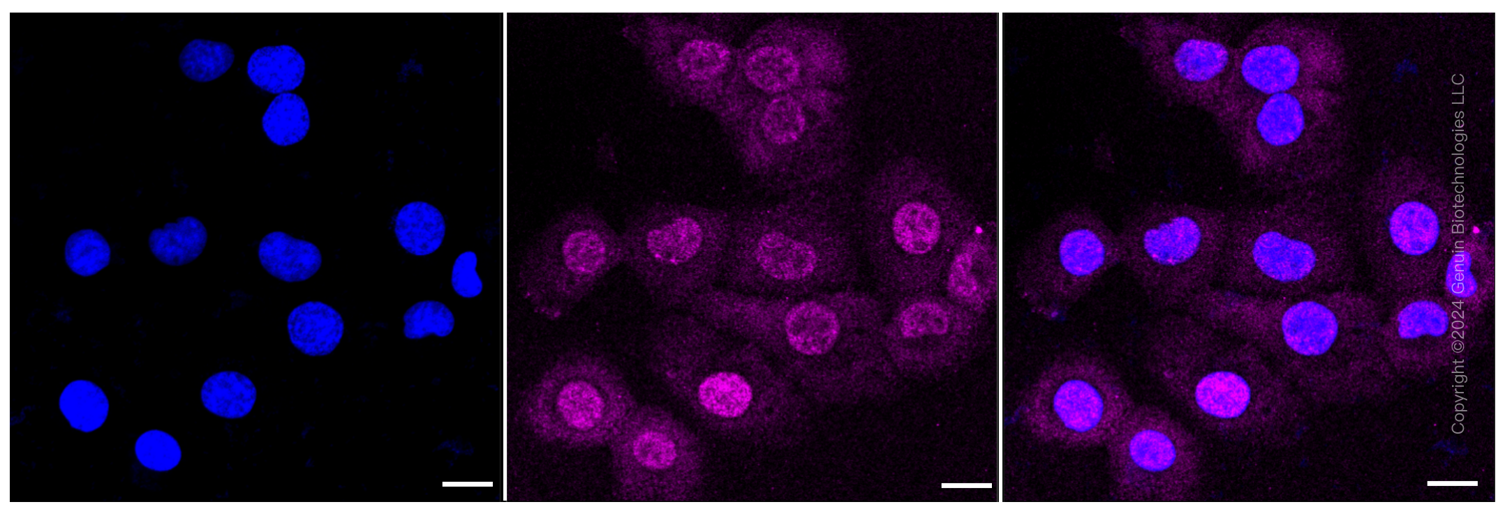 KD-Validated Anti-Glycogen synthase kinase 3 beta Rabbit Monoclonal Antibody ABG2314