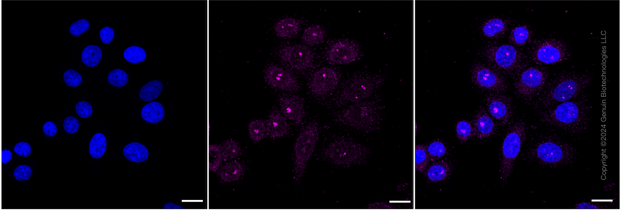 KD-Validated Anti-Bcl-2 Rabbit Monoclonal Antibody ABG2315