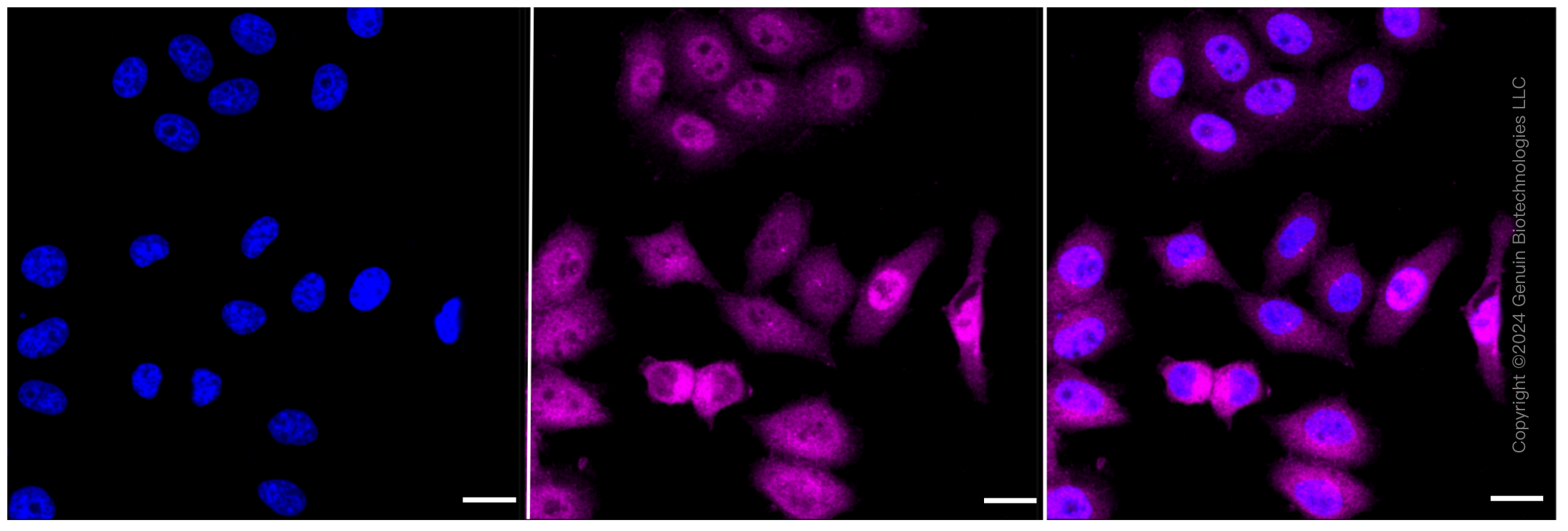 KD-Validated Anti-ATP citrate lyase Rabbit Monoclonal Antibody ABG2316