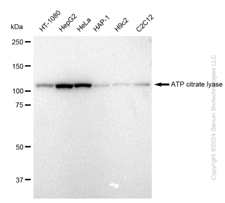 KD-Validated Anti-ATP citrate lyase Rabbit Monoclonal Antibody ABG2316