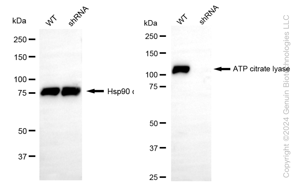 KD-Validated Anti-ATP citrate lyase Rabbit Monoclonal Antibody ABG2316