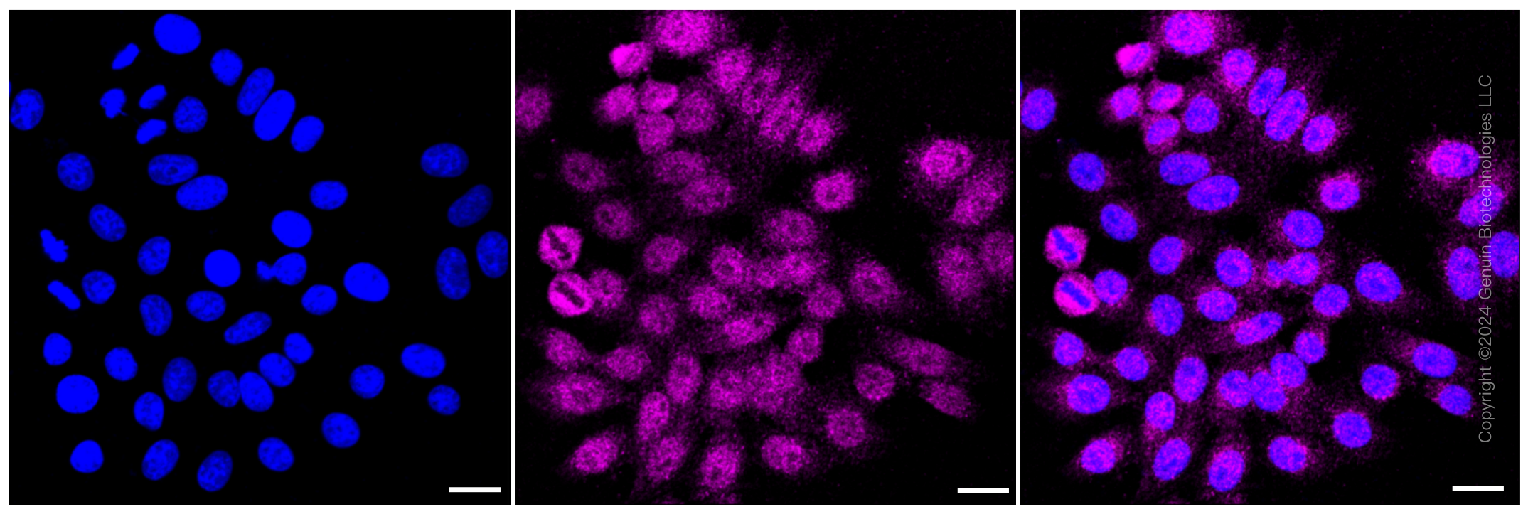 KD-Validated Anti-Vesicle associated membrane protein 2 Rabbit Monoclonal Antibody ABG2317