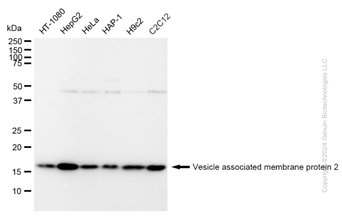 KD-Validated Anti-Vesicle associated membrane protein 2 Rabbit Monoclonal Antibody ABG2317