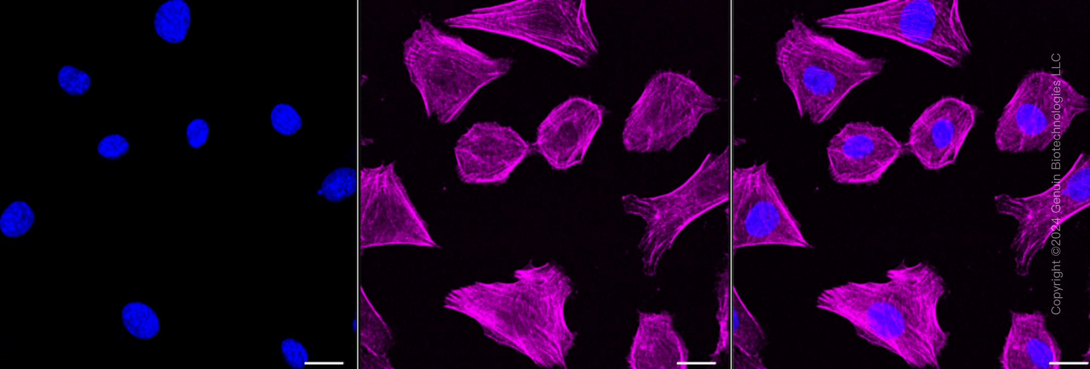 KD-Validated Anti-alpha smooth muscle Actin Rabbit Monoclonal Antibody ABG2319