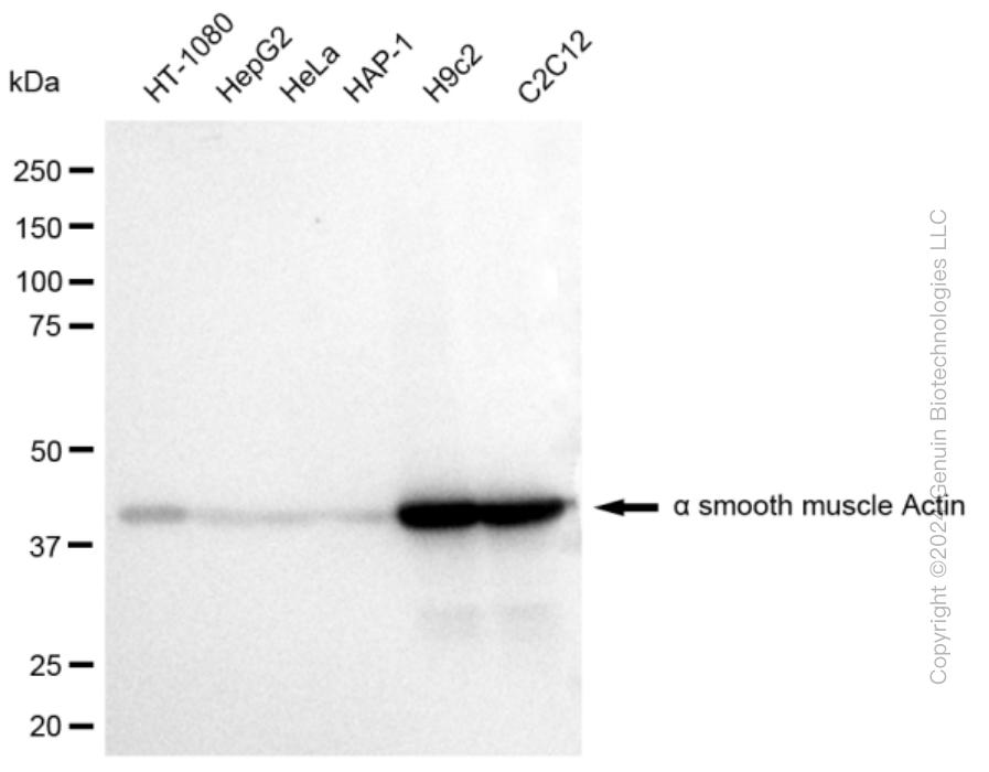KD-Validated Anti-alpha smooth muscle Actin Rabbit Monoclonal Antibody ABG2319