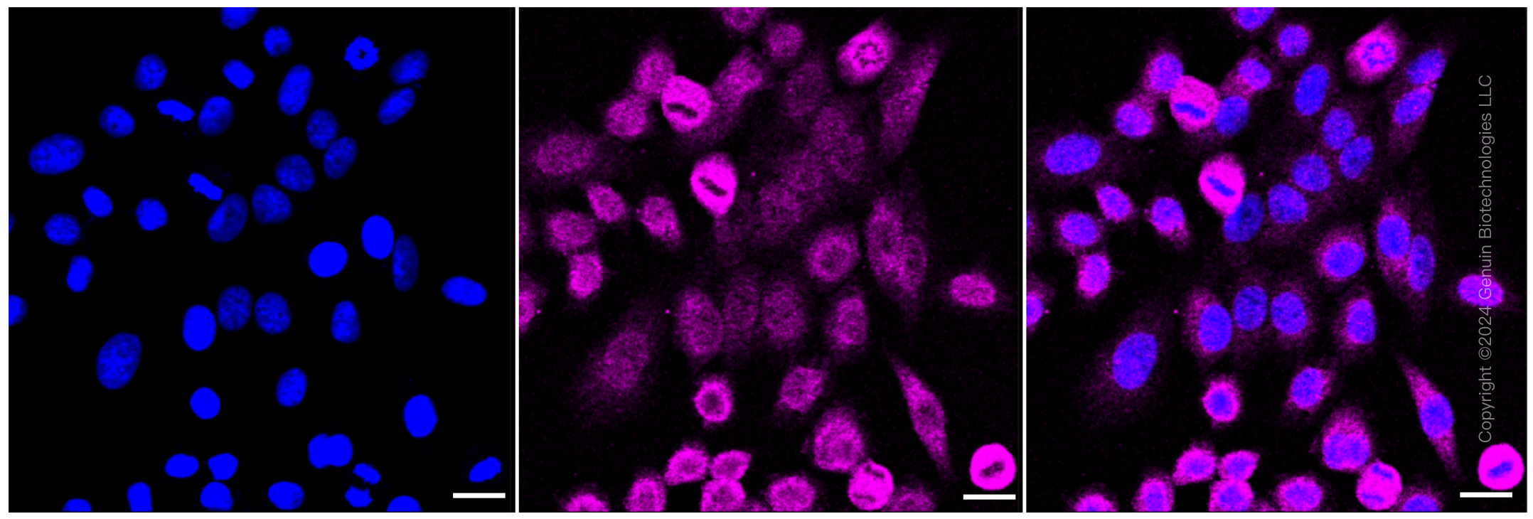 KD-Validated Anti-PRKRA Rabbit Monoclonal Antibody ABG2320