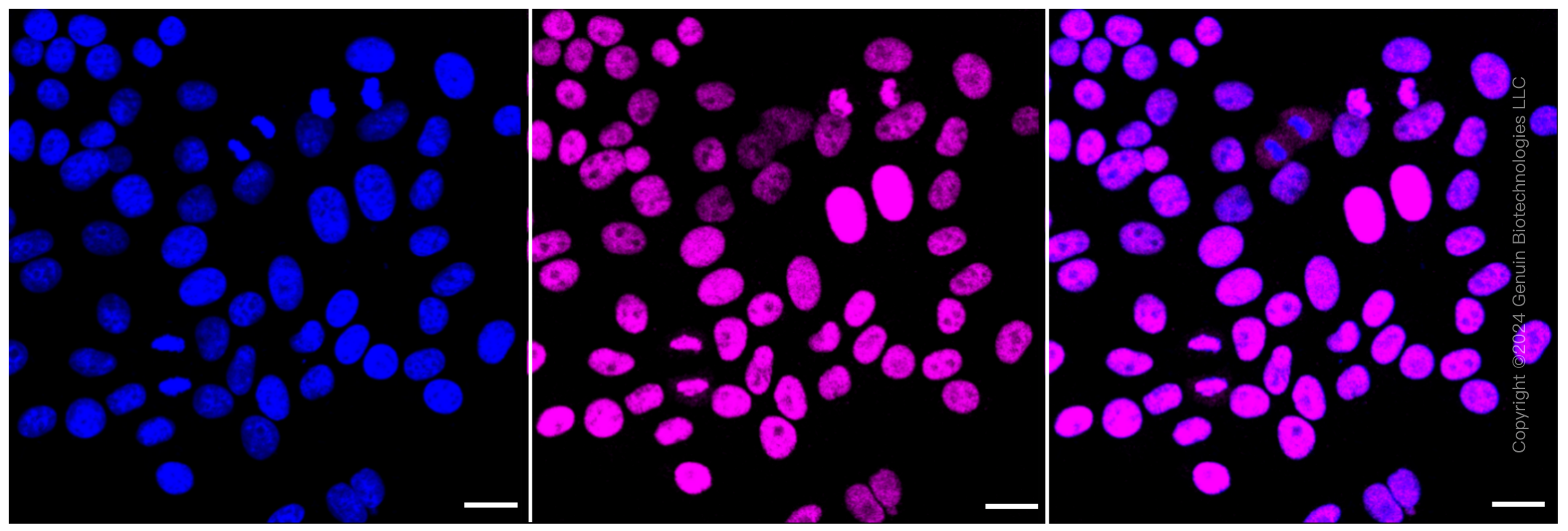 KD-Validated Anti-Chromodomain helicase DNA binding protein 3 Rabbit Monoclonal Antibody ABG2321