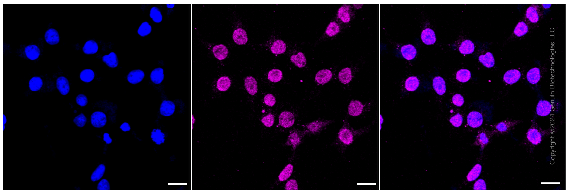 KD-Validated Anti-CD163 Rabbit Monoclonal Antibody ABG2326