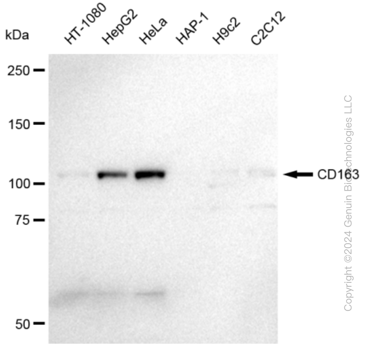 KD-Validated Anti-CD163 Rabbit Monoclonal Antibody ABG2326
