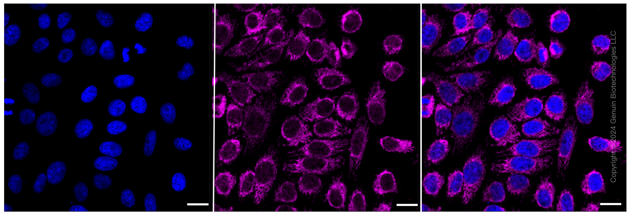 KD-Validated Anti-CLPP Rabbit Monoclonal Antibody ABG2328