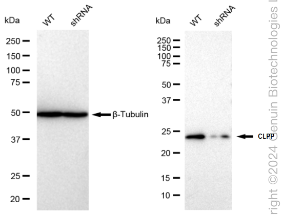 KD-Validated Anti-CLPP Rabbit Monoclonal Antibody ABG2328