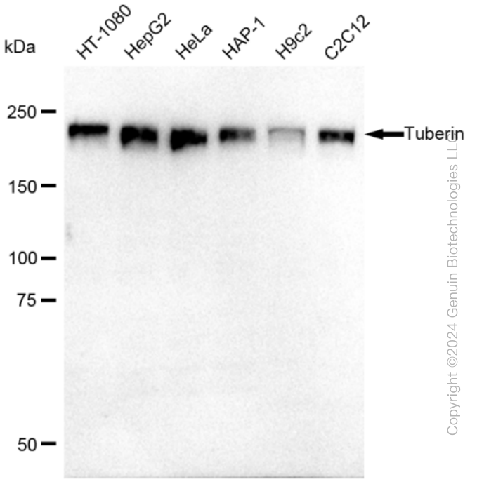 KD-Validated Anti-Tuberin Rabbit Monoclonal Antibody ABG2338
