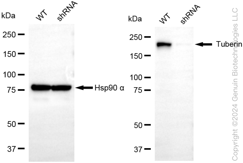 KD-Validated Anti-Tuberin Rabbit Monoclonal Antibody ABG2338