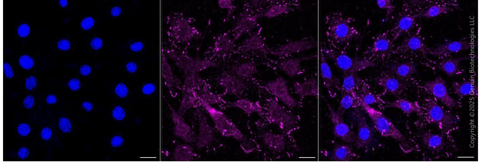 KD-Validated Anti-Integrin beta 3 Rabbit Monoclonal Antibody ABG2340