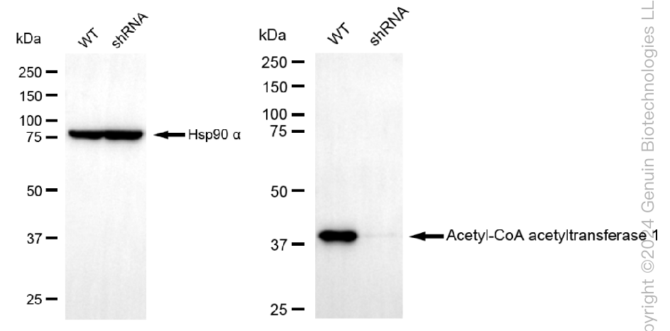 KD-Validated Anti-Acetyl-CoA acetyltransferase 1 Rabbit Monoclonal Antibody ABG2343