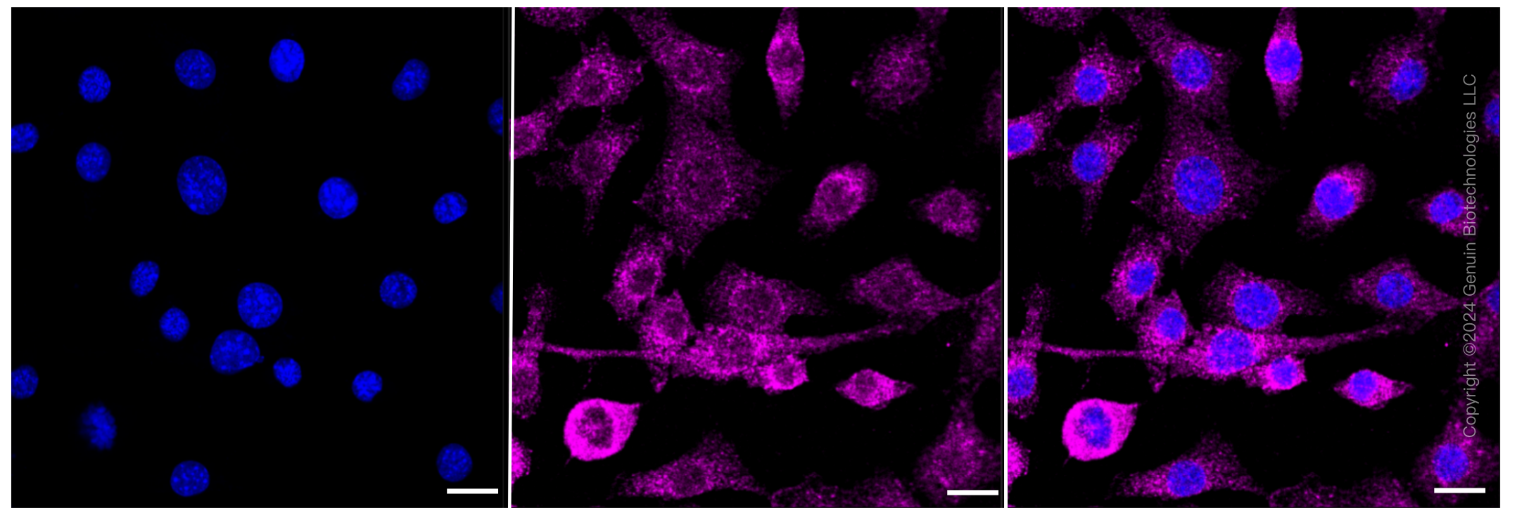 KD-Validated Anti-Arp3 Rabbit Monoclonal Antibody ABG2347