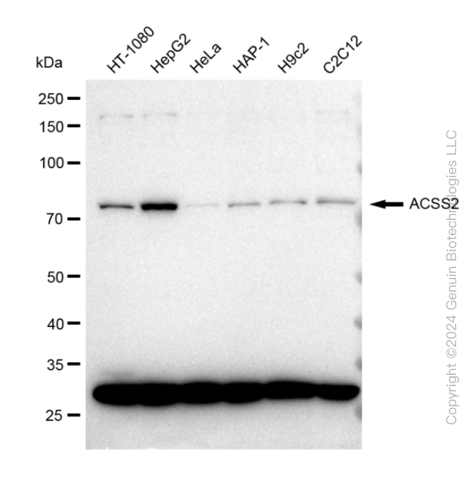 KD-Validated Anti-ACSS2 Rabbit Monoclonal Antibody ABG2350