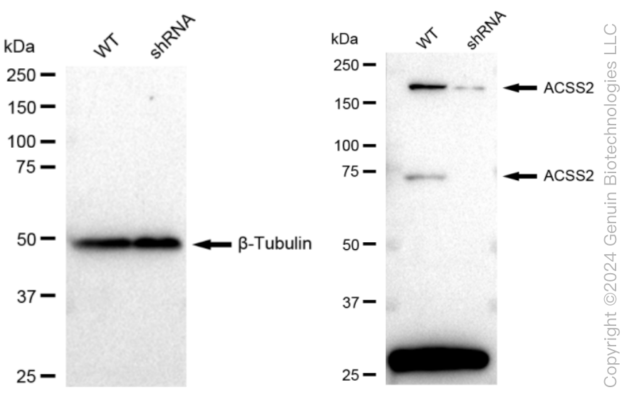 KD-Validated Anti-ACSS2 Rabbit Monoclonal Antibody ABG2350