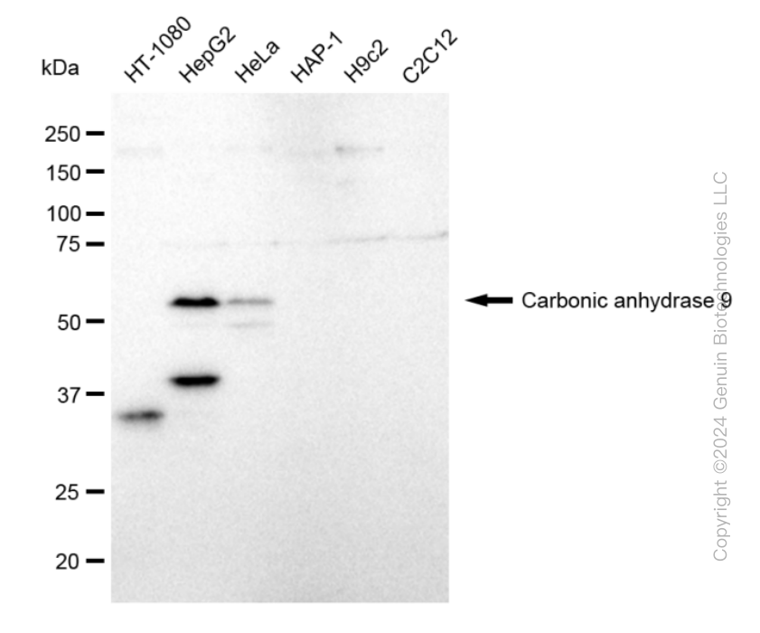 KD-Validated Anti-Carbonic anhydrase 9 Rabbit Monoclonal Antibody ABG2352
