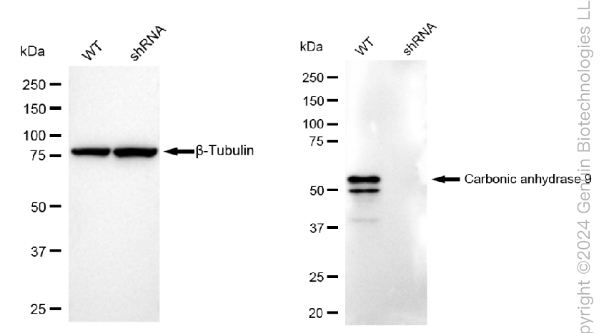 KD-Validated Anti-Carbonic anhydrase 9 Rabbit Monoclonal Antibody ABG2352