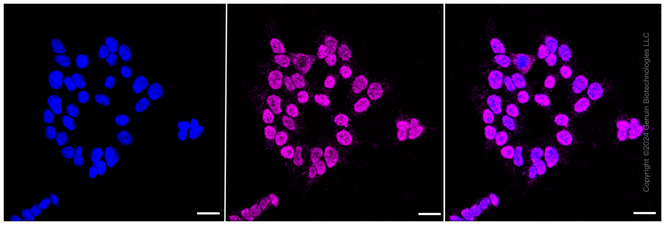 KD-Validated Anti-ADK Rabbit Monoclonal Antibody ABG2354