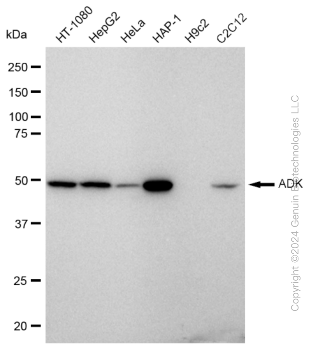 KD-Validated Anti-ADK Rabbit Monoclonal Antibody ABG2354