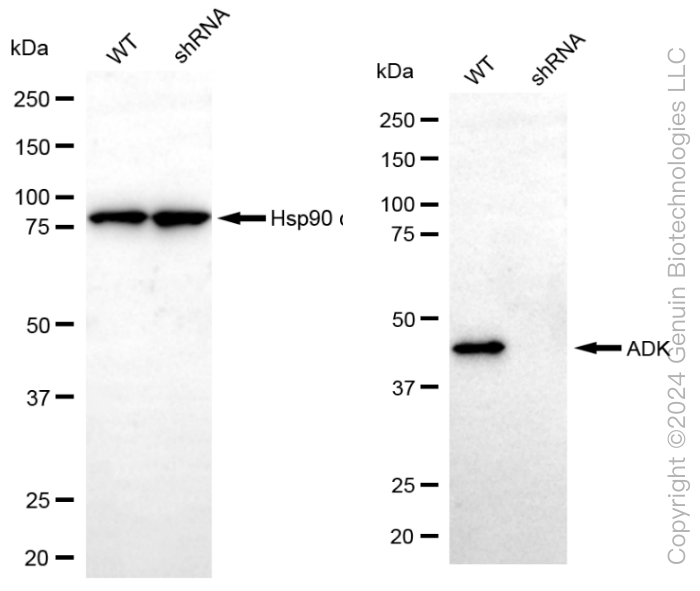 KD-Validated Anti-ADK Rabbit Monoclonal Antibody ABG2354
