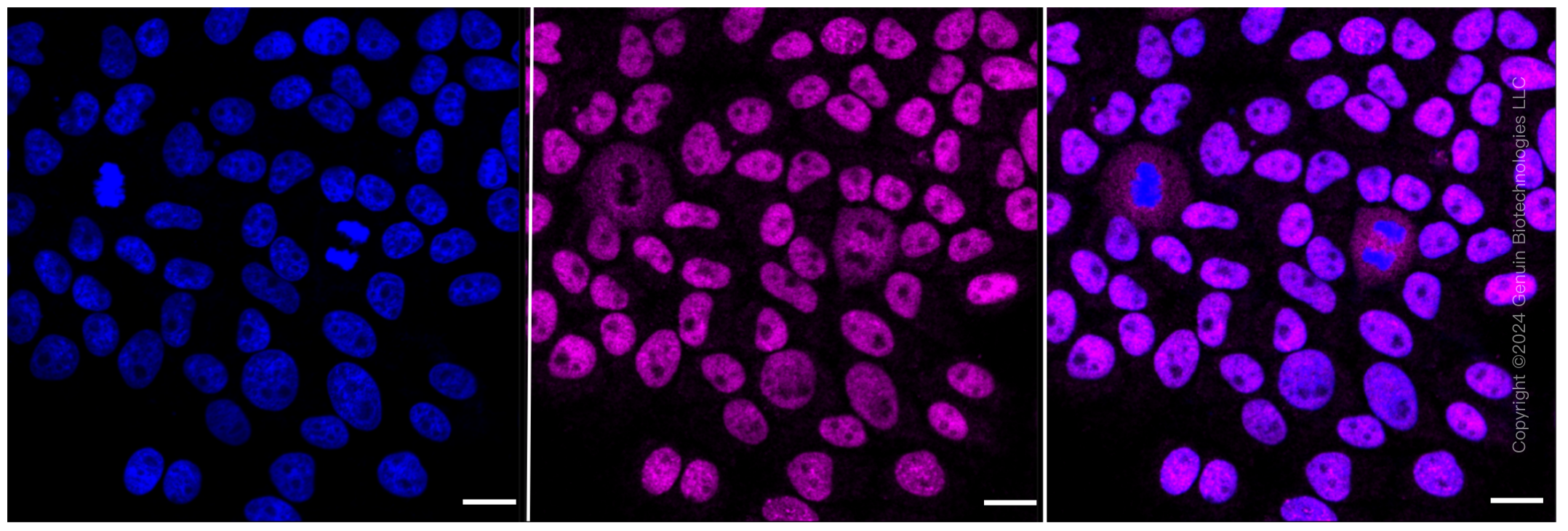 KD-Validated Anti-p150 CAF1 Rabbit Monoclonal Antibody ABG2356