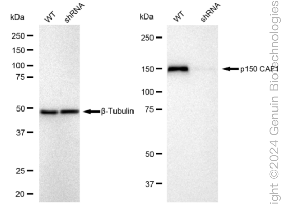 KD-Validated Anti-p150 CAF1 Rabbit Monoclonal Antibody ABG2356