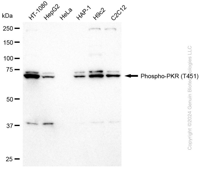 KD-Validated Anti-Phospho-PKR (T451) Rabbit Monoclonal Antibody ABG2357