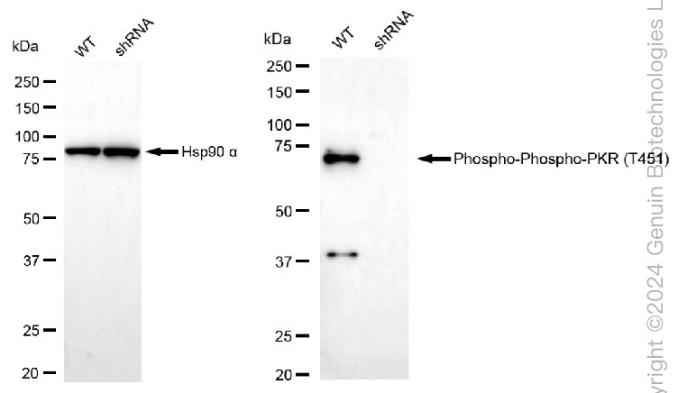 KD-Validated Anti-Phospho-PKR (T451) Rabbit Monoclonal Antibody ABG2357