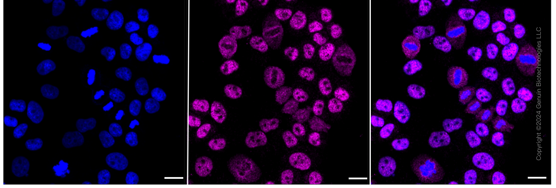 KD-Validated Anti-RING1 Rabbit Monoclonal Antibody ABG2358